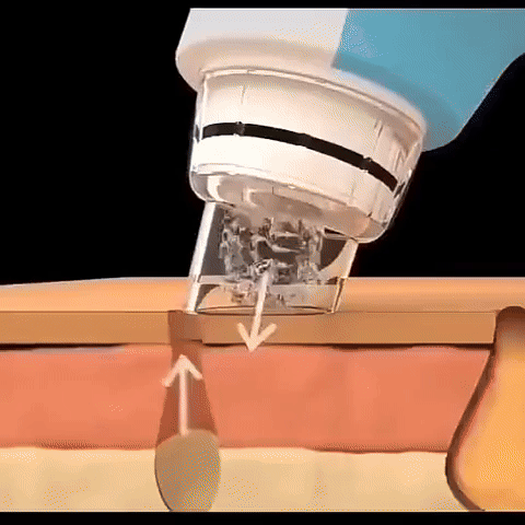 🌸 Aspirateur à Points Noirs & Nettoyeur Visage Hydratant – Technologie Professionnelle